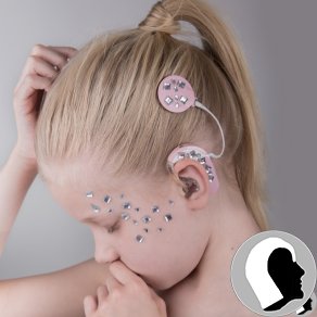 CI Kopf 2018 weiblich Kind